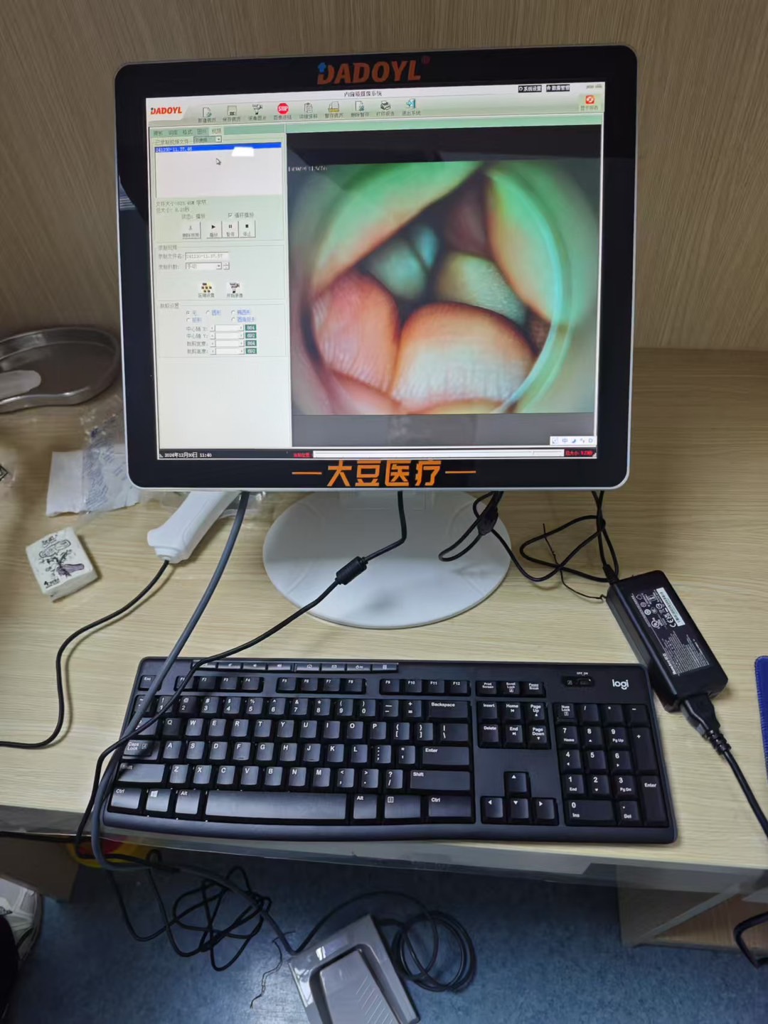 【大豆醫(yī)療】云南省某醫(yī)院便攜式電子肛門鏡DD-100型裝機(jī)培訓(xùn)